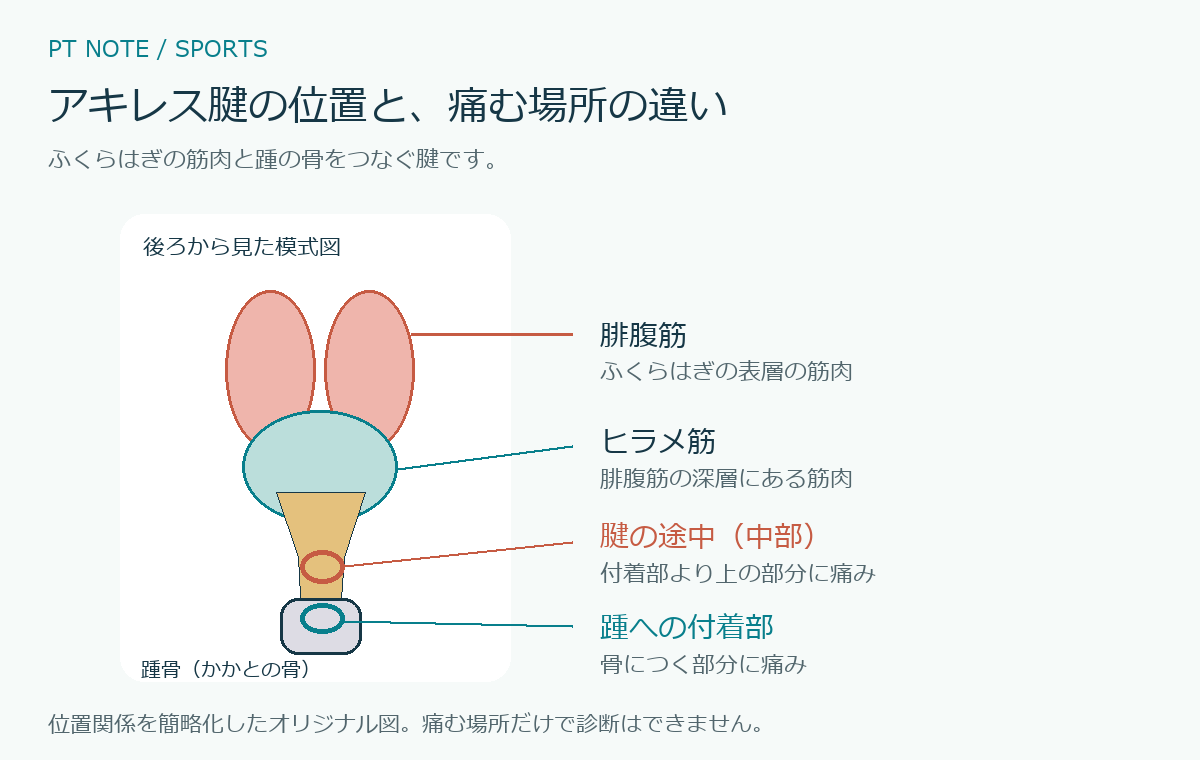 腓腹筋・ヒラメ筋から踵骨へつながるアキレス腱と、中部・付着部の位置を示す模式図