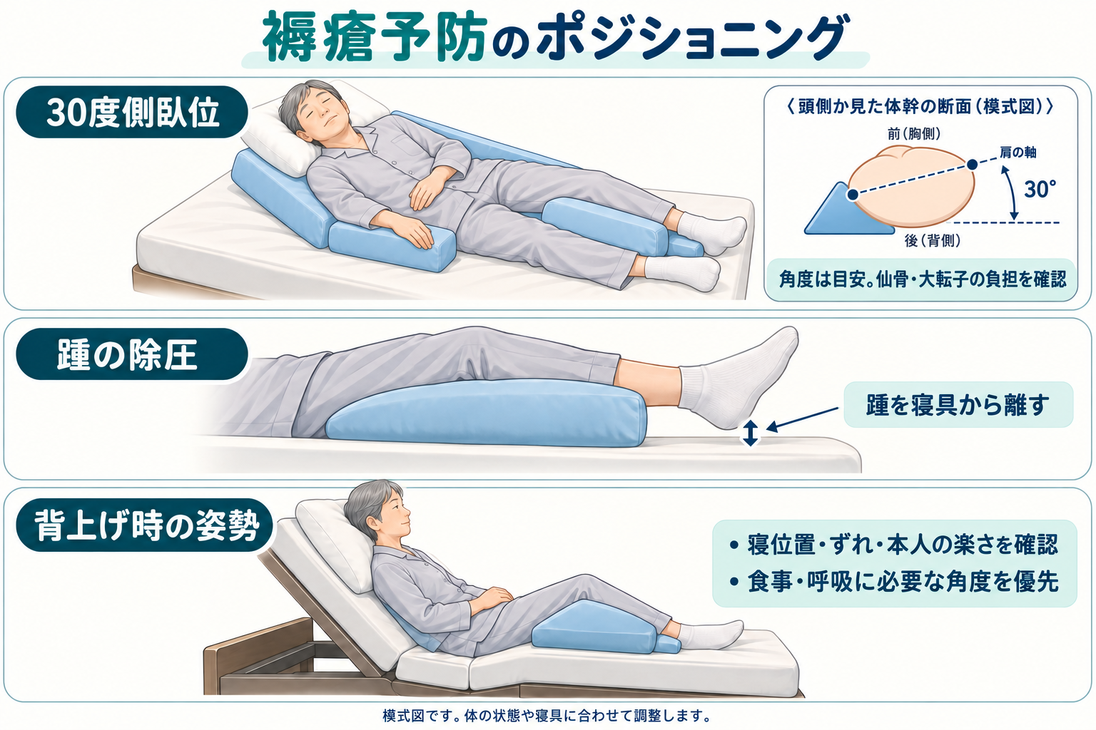30度側臥位で背中と脚を支える姿勢、踵の除圧、背上げ時の寝位置を示す模式図